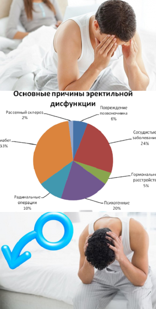 методы лечения ЭД
